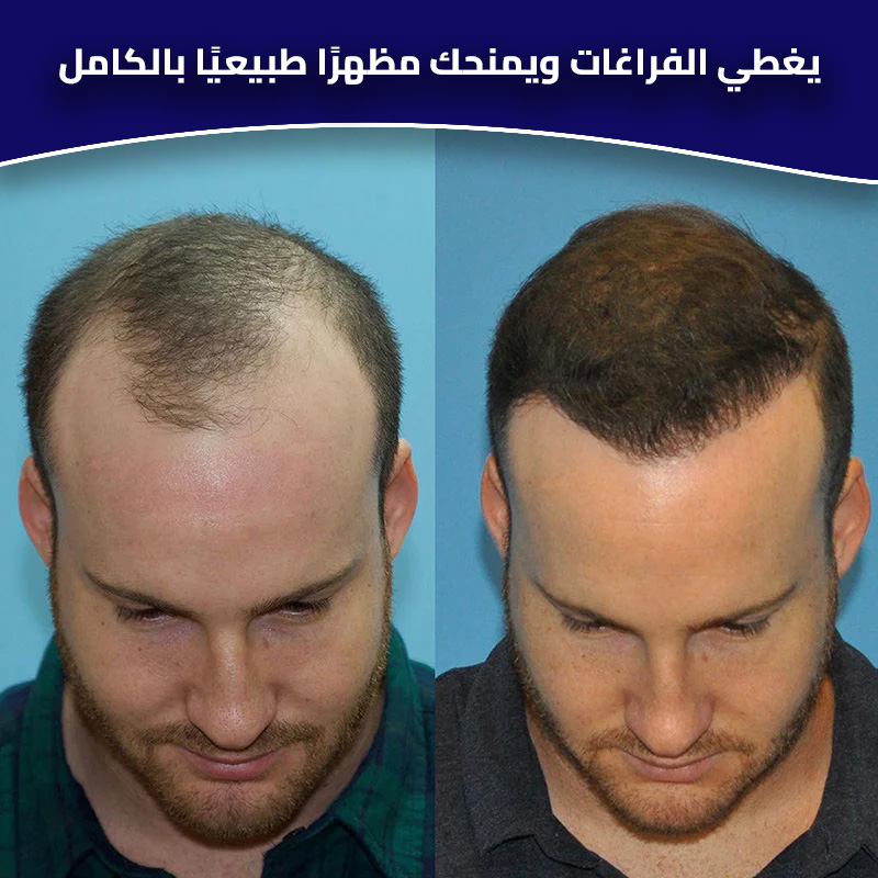 HIAR BUILDING fiber 2